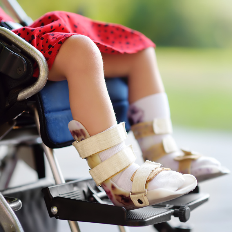 Disabled girl sitting in wheelchair. On her legs orthosis. Child cerebral palsy. Inclusion. Family with disabled kid.